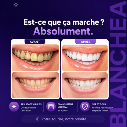Blanchea - Bandes Blanchissantes Blancheur Immédiate